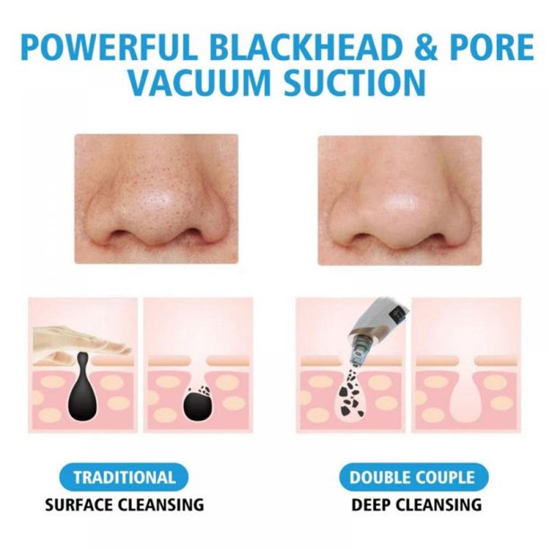 Electric Blackhead Suction Remover for Deep Pores